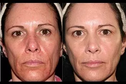 Best Specific Stem Cell Therapy Clinic in Dubai & Abu Dhabi