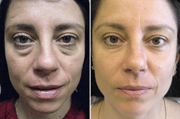 Best Specific Stem Cell Therapy Clinic in Dubai