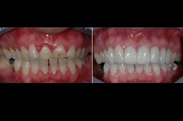 Best Why Do We Need Cosmetic Dentistry Treatments Clinic in Dubai & Abu Dhabi