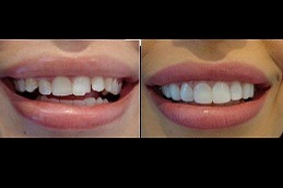 Best Why Do We Need Cosmetic Dentistry Treatments Clinic in Dubai