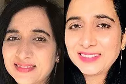 Glutathione in Dubai