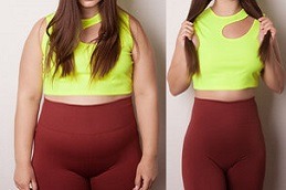 Does Gastric Plication Work For Weight Loss Clinic in Abu Dhabi