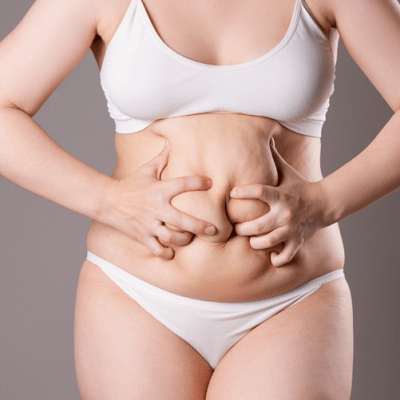 Does Liposuction Treatment Leaves A Scar in Dubai & Abu Dhabi