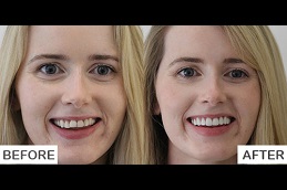 Facial Pain Clinic in Abu Dhabi