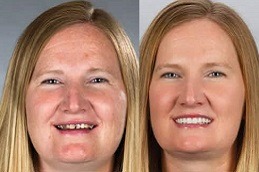 Facial Pain Clinic in Dubai & Abu Dhabi