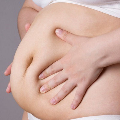 Is Gastric Bypass A Permanent Weight Loss Procedure?