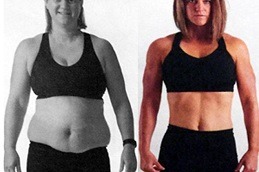 Is Weight Loss With The Mini Gastric Bypass Safe Clinic in Dubai & Abu Dhabi