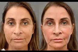 Specific Stem Cell Therapy Clinic in Abu Dhabi