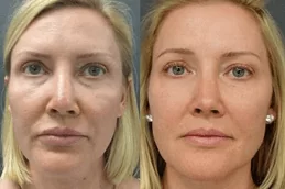 Specific Stem Cell Therapy in Dubai