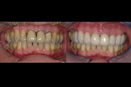 Why Do We Need Cosmetic Dentistry Treatments Clinic in Abu Dhabi