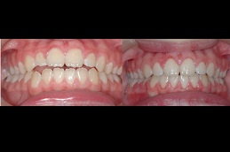 Why Do We Need Cosmetic Dentistry Treatments Clinic in Dubai & Abu Dhabi