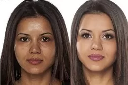 Why Does Glutathione Cause Acne Breakouts Dubai