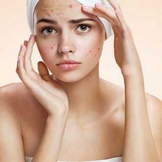 Why Does Glutathione Cause Acne Breakouts?
