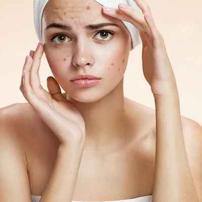 can glutathione cause breakouts Why Does Acne In Dubai & Abu Dhabi Single Product Size:55 lb / 25 kg 6000 mg glutathione injection