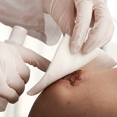 Wound Dressing in Dubai, Abu Dhabi & Sharjah | Royal Clinic