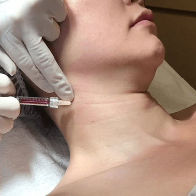 Botox For Neck Wrinkles - Is It Right For You in Dubai & Abu Dhabi