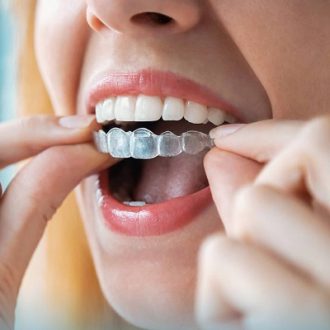 Can Invisalign Help You Achieve A Perfect Smile?