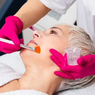 Glycolic Acid Peels: Reveal A Youthful Glow