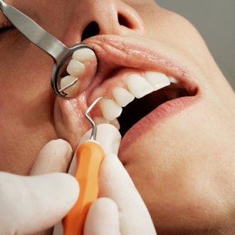 How Do I Know If I Need A Root Canal Or A Tooth Filling?