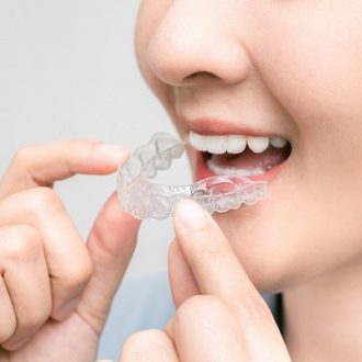 How Do I Know If My Aligners Are Working?