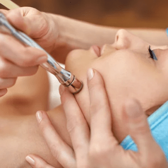 Microdermabrasion with Ultrasound for Radiant Skin