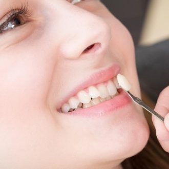 What Happens If You Crack A Veneer in Dubai?