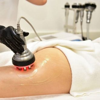 10 Reasons to Consider Cellulite Treatment