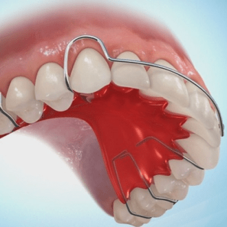 Can Clear Aligners Push Teeth Back in Dubai?