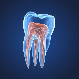 Endodontic Dubai | Root Canal Treatment