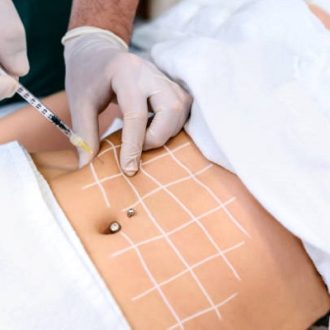 Gastric Botox Injection For Weight Loss in Dubai