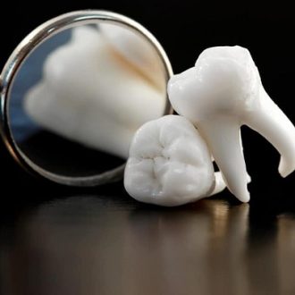 The Six Teeth That Matter Most For Your Beautiful Smile