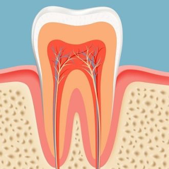 Why Does My Root Canal Tooth Hurt in Dubai?