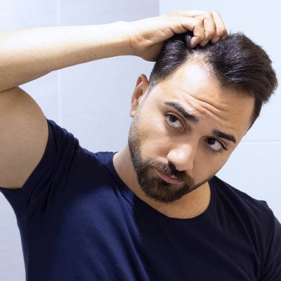 Baldness Be Gone With Our Hair Transplantation Solutions in Dubai