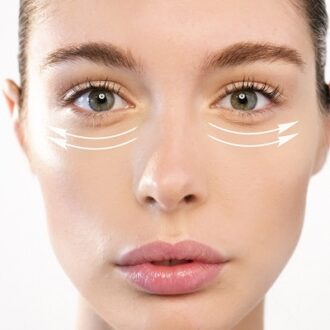 Exploring The Benefits Of Eye Bag Removal In Dubai