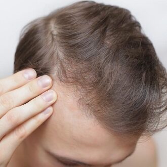 Hair Today, Hair Tomorrow With Our Restoration Treatments