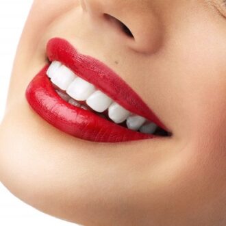 How Can I Whiten My Yellow Teeth Fast in Dubai?