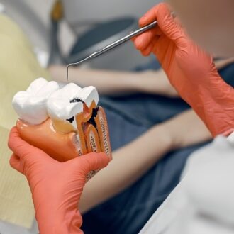 How Can Root Canals Be Prevented in Dubai
