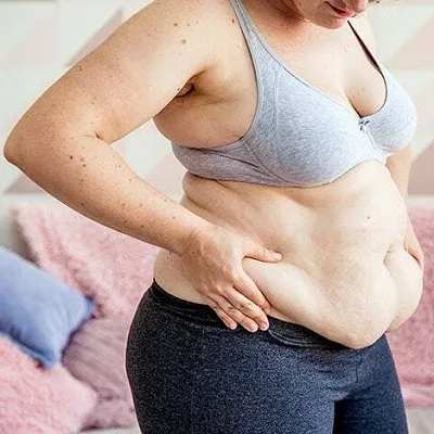 Best Gastric Bypass In Dubai & Abu Dhabi | Mini Gastric Bypass Cost