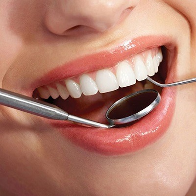 How To Remove Smoking Stains From Teeth?