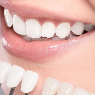 If I Get Veneers How Will I Brush My Real Teeth?