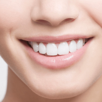 Is Hollywood Smile A Good Idea in Dubai?