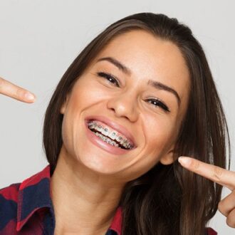 Is There An Age Limit To Get Braces in Dubai