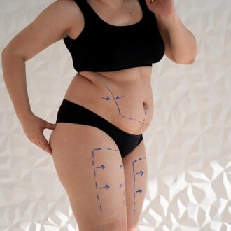 Proven Methods For Reducing Cellulite Appearance