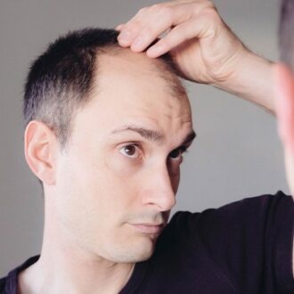 Reclaim Your Youth With A Full Head Of Hair