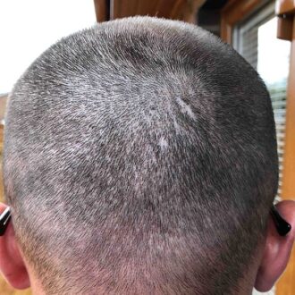 Tried And Tested Treatments For Healthy Hair Regrowth