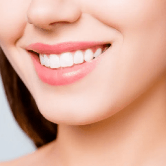 Why Is Teeth Whitening So Popular In Dubai?