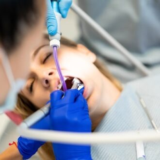 Can A Cavity Grow On A Root Canal in Dubai