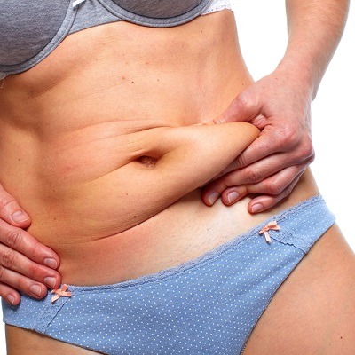 Is The Pubic Area Lifted With Tummy Tuck Surgery?