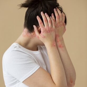 Reclaiming Your Complexion: The Art Of Treating Actinic Keratosis