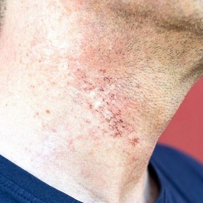 Skin Disease Solutions: What You Need To Know